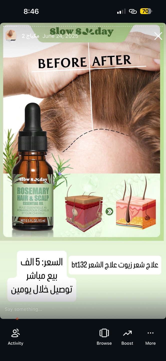 زيت إكليل الجبل للشعر وفروة الرأس